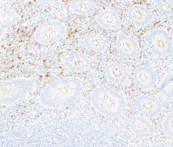 Rabbit anti-Interferon alpha/ beta receptor 1 Recombinant Monoclonal Antibody