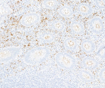 Interferon alpha/beta receptor 1 Antibody