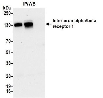 Interferon alpha/beta receptor 1 Antibody