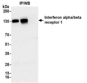 Rabbit anti-Interferon alpha/ beta receptor 1 Recombinant Monoclonal Antibody