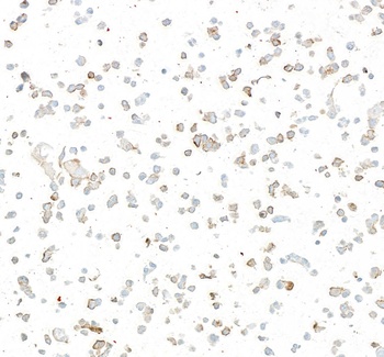 Rabbit anti-LOX-1 Recombinant Monoclonal Antibody
