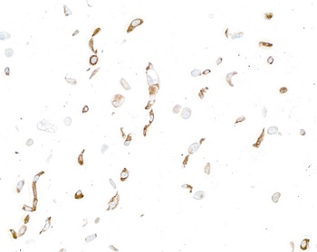 Rabbit anti-LOX-1 Recombinant Monoclonal Antibody