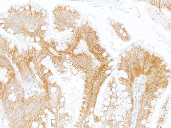 Rabbit anti-LOX-1 Recombinant Monoclonal Antibody