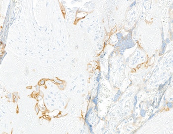 Rabbit anti-LOX-1 Recombinant Monoclonal Antibody