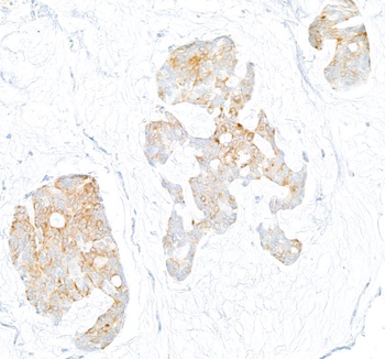 Rabbit anti-LOX-1 Recombinant Monoclonal Antibody