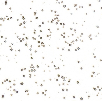 Rabbit anti-Thrombomodulin Recombinant Monoclonal Antibody