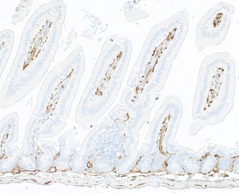 Rabbit anti-Thrombomodulin Recombinant Monoclonal Antibody