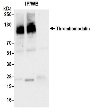 Rabbit anti-Thrombomodulin Recombinant Monoclonal Antibody