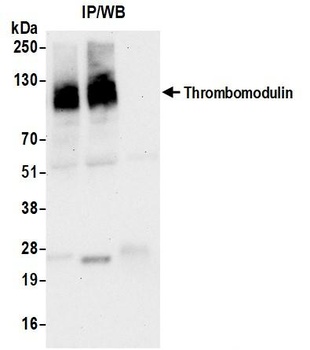 Thrombomodulin Antibody