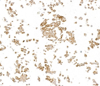 Rabbit anti-LYRIC/AEG1 Recombinant Monoclonal Antibody