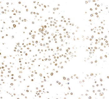 Rabbit anti-LYRIC/AEG1 Recombinant Monoclonal Antibody