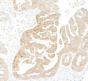 Rabbit anti-LYRIC/AEG1 Recombinant Monoclonal Antibody