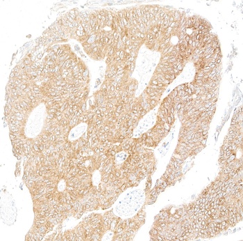 Rabbit anti-LYRIC/AEG1 Recombinant Monoclonal Antibody