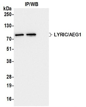 LYRIC/AEG1 Antibody