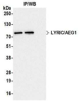Rabbit anti-LYRIC/AEG1 Recombinant Monoclonal Antibody