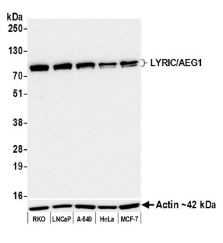 Rabbit anti-LYRIC/AEG1 Recombinant Monoclonal Antibody