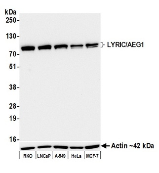 LYRIC/AEG1 Antibody