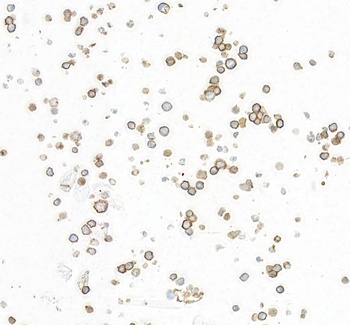 Rabbit anti-CD86 Recombinant Monoclonal Antibody