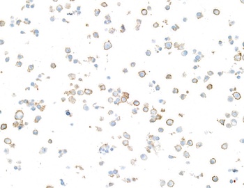 Rabbit anti-CD86 Recombinant Monoclonal Antibody