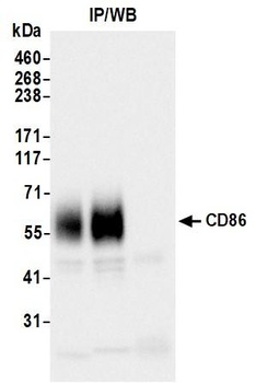 Rabbit anti-CD86 Recombinant Monoclonal Antibody
