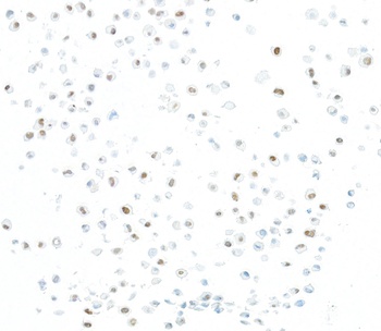 Rabbit anti-JMJD6 Recombinant Monoclonal Antibody
