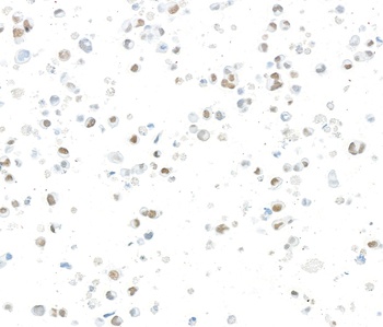 Rabbit anti-JMJD6 Recombinant Monoclonal Antibody