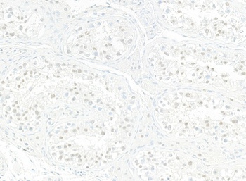 Rabbit anti-JMJD6 Recombinant Monoclonal Antibody