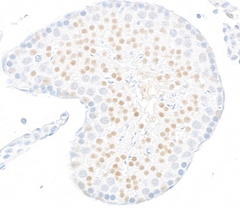 Rabbit anti-JMJD6 Recombinant Monoclonal Antibody