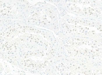 JMJD6 Antibody