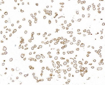 Rabbit anti-Thrombomodulin Recombinant Monoclonal Antibody