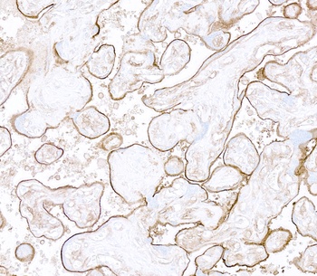 Rabbit anti-Thrombomodulin Recombinant Monoclonal Antibody
