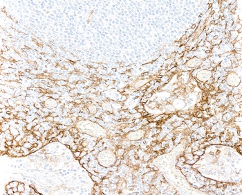 Rabbit anti-Thrombomodulin Recombinant Monoclonal Antibody