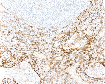 Thrombomodulin Antibody