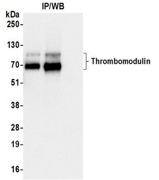 Thrombomodulin Antibody
