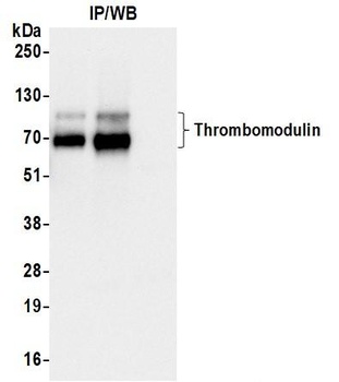 Rabbit anti-Thrombomodulin Recombinant Monoclonal Antibody