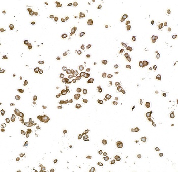 Rabbit anti-EGFR Recombinant Monoclonal Antibody