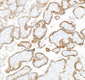 Rabbit anti-EGFR Recombinant Monoclonal Antibody