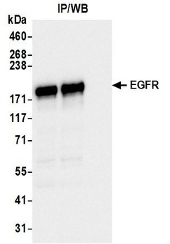 Rabbit anti-EGFR Recombinant Monoclonal Antibody