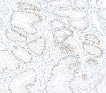 KLF4 Antibody