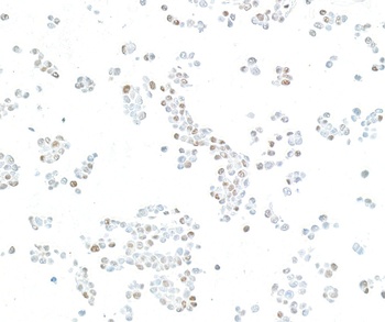 Rabbit anti-KLF4 Recombinant Monoclonal Antibody
