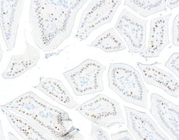Rabbit anti-KLF4 Recombinant Monoclonal Antibody