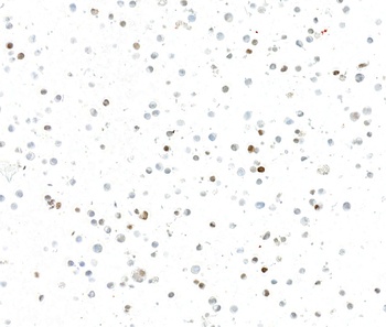 Rabbit anti-INSM1 Recombinant Monoclonal Antibody