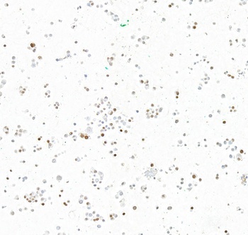 Rabbit anti-INSM1 Recombinant Monoclonal Antibody