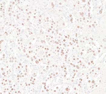 Rabbit anti-INSM1 Recombinant Monoclonal Antibody
