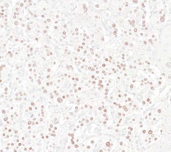 INSM1 Antibody