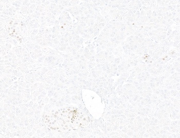 Rabbit anti-INSM1 Recombinant Monoclonal Antibody