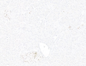 INSM1 Antibody