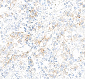 Rabbit anti-c-Kit Recombinant Monoclonal Antibody