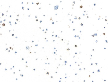 Rabbit anti-c-Kit Recombinant Monoclonal Antibody
