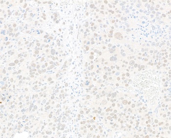Rabbit anti-JDP2 Recombinant Monoclonal Antibody